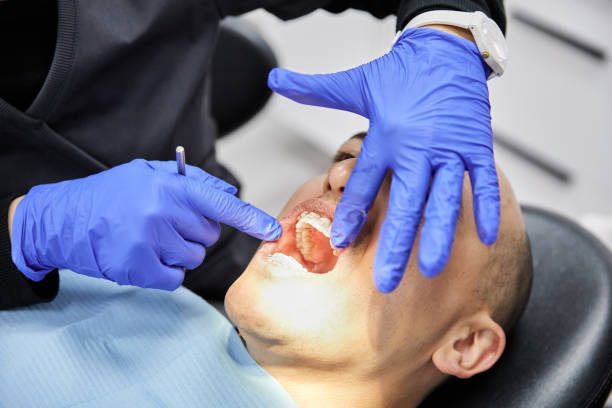 Best Knocked-Out Tooth (Avulsed Tooth) Treatment in Appomattox, VA